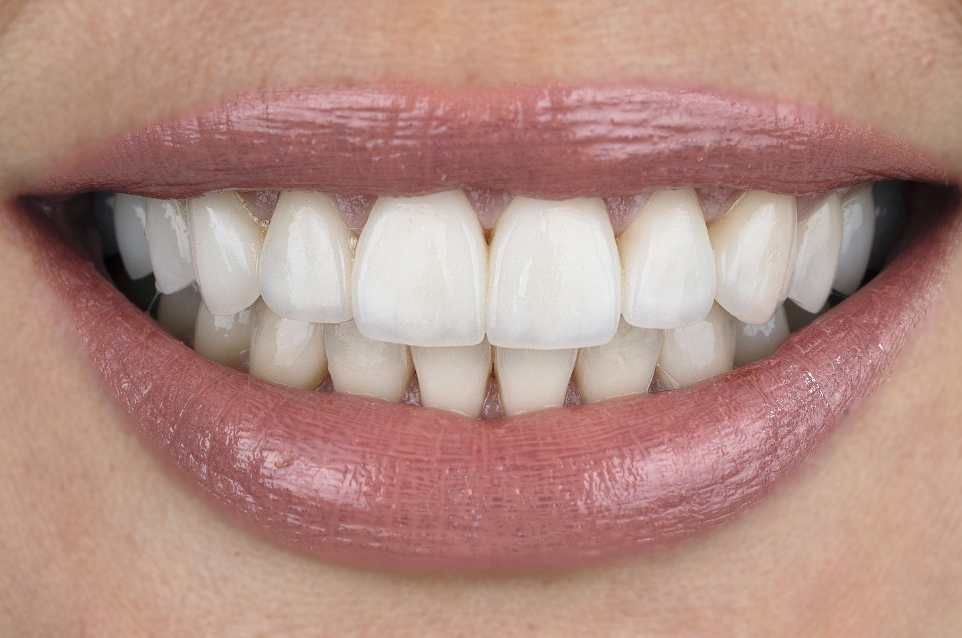 Before and After Photos (1)